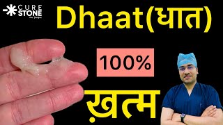 Dhaatधात 100 ख़तम  Dhaat Syndrome Hindi  धात रोग क्या और कैसे होता है  धात रोग का इलाज [upl. by Idelia38]