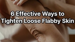 How to Get Rid of Loose Flabby Skin SKIN TIGHTENING health healthtips [upl. by Akinor]