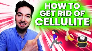 How To Get Rid Of Cellulite Treatment and Removal Medical Info [upl. by Deadman]