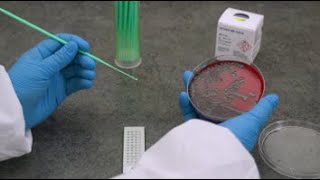 VITEK MS Sample Prep  BacteriaYeast Using a Loop [upl. by Anna-Diane]