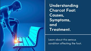 Charcot Foot Explained [upl. by Annoerb]