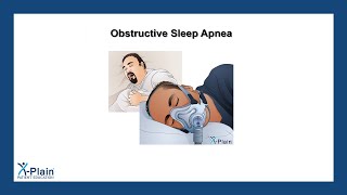 Obstructive Sleep Apnea [upl. by Willin]