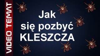 Jak usunąć kleszcza  Skuteczne sposoby na kleszcze [upl. by Scoville]