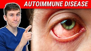 The SHOCKING Truth about Autoimmune Disease and Eye Health [upl. by Chlores]