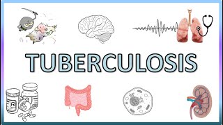 Tuberculosis  Types Pathogenesis Signs and Symptoms Diagnosis Treatment and Prevention [upl. by Nepean]