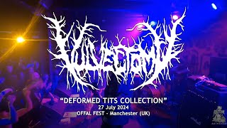 Vulvectomy quotDeformed Tits Collectionquot Live  Offal Fest 2024 [upl. by Daahsar]