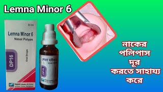 Lemna Minor 6 \\Nasal Polyps\\Oral Drops\\ নাকের পলিপাস চিকিৎসা ঔষধ সেবন করুন Bangla Review [upl. by Ardnekahs]