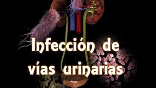 Infección de vías urinarias IVU [upl. by Lleruj]