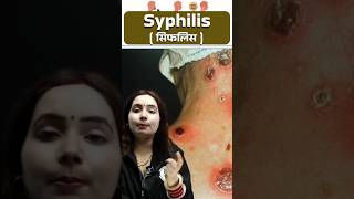 सिफलिस Syphilis रोग  Syphilis Causes Symptoms Treatment  STD disease Shorts Science PW [upl. by Nytram]