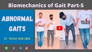 Antalgic gait Hemiplegic gait All Abnormal Gait Demonstration Gait biomechanics [upl. by Adnala]