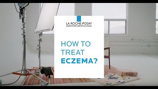 How to Treat Eczema  DERMCLASS [upl. by Buckingham626]