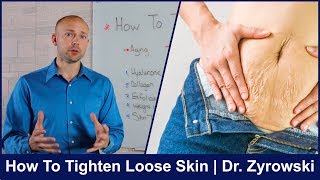 How To Tighten Loose Skin  The Best Methods [upl. by Duane162]