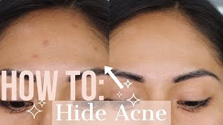 How To Hide Acne With Concealer  Easy How To Hide Acne or Acne Scars [upl. by Airogerg39]