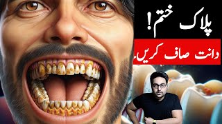 Dr ZeeTop Remedy To get rid of Dental Plaque TARTAR  डॉक्टर ज़ी [upl. by Barolet]