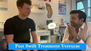 Verruca Swift Microwave Treatment Successful  Abid Hussain Podiatrist [upl. by Jaunita77]