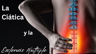 La Ciática y la Esclerosis Múltiple esclerosismultiple esclerosismúltiple [upl. by Naesar]