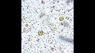 Blastocystis hominis [upl. by Kendell691]