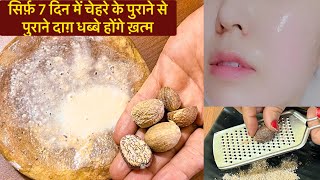 7 दिन में कितनी भी पुरानी झाइयाँ Pigmentation जड़ से ख़त्म करें Nutmeg Face pack [upl. by Nerol]