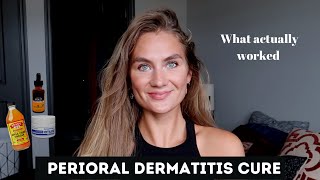 Perioral Dermatitis Treatment [upl. by Hollie418]