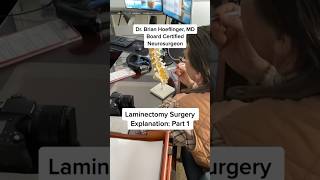 Laminectomy Surgery Explanation with Model doctor healthcare learning [upl. by Yc164]