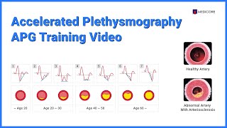 Accelerated Plethysmography  APG Training Video [upl. by Frohman]