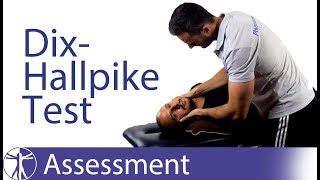 Dix Hallpike Test  Posterior BPPV [upl. by Yauq]