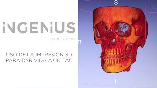 Uso de la impresión 3D para dar vida a un TAC [upl. by Leong]