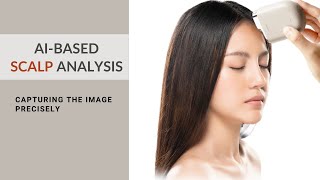 How to capture the image  Scalp analysis [upl. by Aicillyhp]