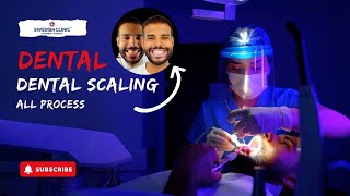 Dental Scaling All Process [upl. by Odnuges]