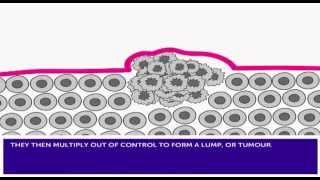 How Cancer Develops amp Mutation [upl. by Wagner]