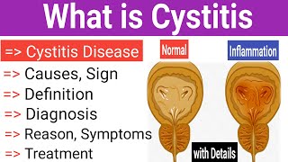 What is cystitis  Causes Sign Reason and Symptoms  Diagnosis Treatment MujahidMedicalKnowledge [upl. by Yardley729]