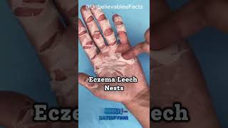 Understanding Hand Peeling Causes Revealed🤲🔍 mindblown didyouknow [upl. by Crescin]