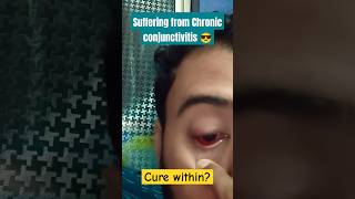 Chronic conjunctivitis synonymsconjunctivitishow many days need for cure [upl. by Dranoel]