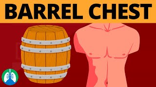 Barrel Chest Medical Definition  Quick Explainer Video [upl. by Novled]