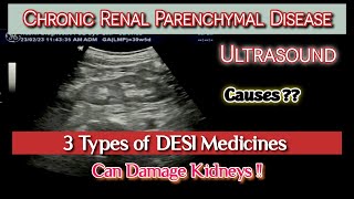 Chronic Renal Parenchymal Disease CKD  Effects of Desi Medicines  Causes  Ultrasound [upl. by Ausoj295]