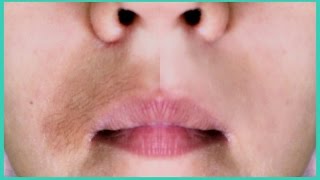 ELIMINA Y ACLARA EL BIGOTE EN 5 MINUTOS NATURALMENTE  Te encantará [upl. by Antons411]