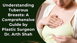 Understanding Tuberous Breasts A Comprehensive Guide by Plastic Surgeon Dr Arth Shah [upl. by Dulcia]