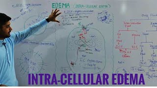 Intracellular edema pathophysiologyedema part 2 [upl. by Maillij]