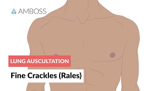 Fine Crackles Rales  Lung Auscultation  Episode 2 [upl. by Andrade]