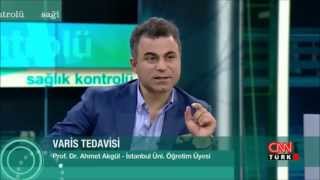 Yanlış ve Eksik yapılan VARİS Ameliyatları ve VARİS Tedavileri  Prof Dr Ahmet AKGÜL [upl. by Bruell]