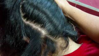 Dandruff Treatment at Home Natural Dandruff Solution Free [upl. by Enelcaj]