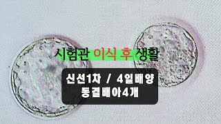 시험관 브이로그 시험관 이식 당일 신선1차 4일배양  동결배아 갯수  무증상이라 더 이상해😜 [upl. by Astraea]