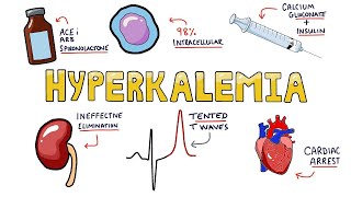 Hyperkalemia  Causes Symptoms Diagnosis and Treatment in Less Than 5 Minutes [upl. by Anivel762]