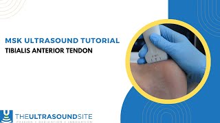 MSK ultrasound of the tibialis anterior tendon [upl. by Tawsha]