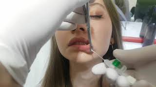 Lip Piercing Care Recovery Time  Dudak Piercing Bakım Ve İyileşme Süresi [upl. by Esenwahs715]