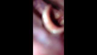 Vocal Folds with iPhone [upl. by Ranna]