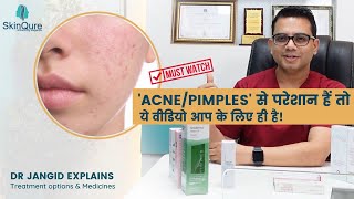 Are you worriend about ACNEPIMPLES  Best medicines for acne  pimples  SkinQure [upl. by Adnarb339]