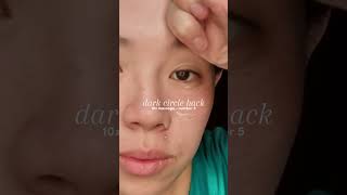 dark circle bye bye  logicallyskin skincare serummencerahkan darkcircles [upl. by Anivlek]