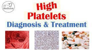 What is Thrombocytosis Diagnosis amp Treatment of High Platelets  Rapid Review [upl. by Demeter]