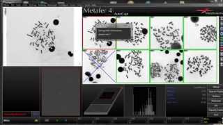 DCScore  Automated Scoring of Dicentric Chromosomes [upl. by Idnek107]